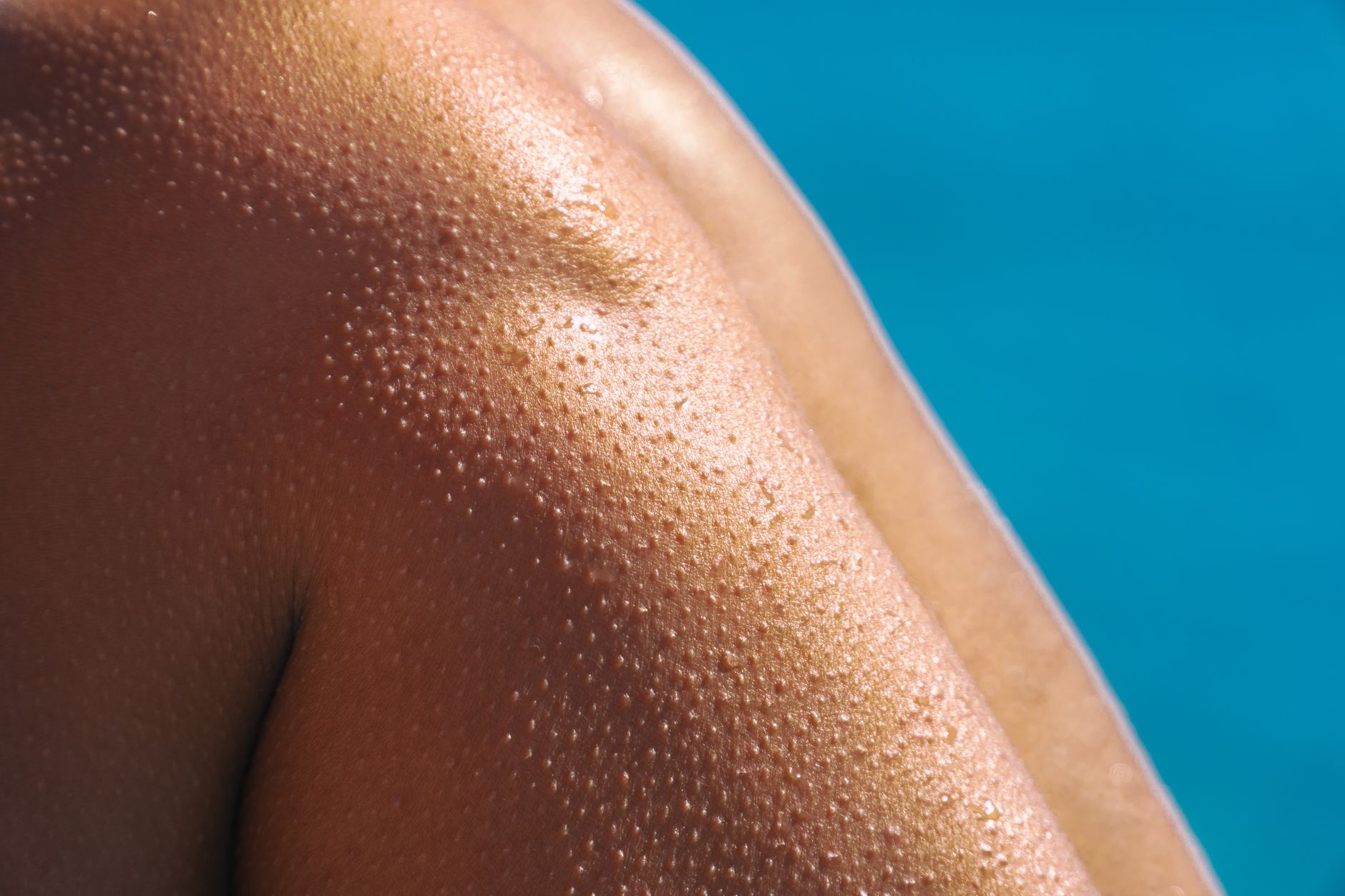 Heat Exhaustion Symptoms Look Like a Bad Afternoon: Act at the First Headache